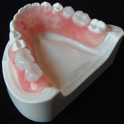 深圳假牙加工|烤瓷牙|隐形全口义齿|种植牙|隐义支架活动托