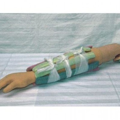 益联医学上臂骨折模型 骨折包扎固定护理