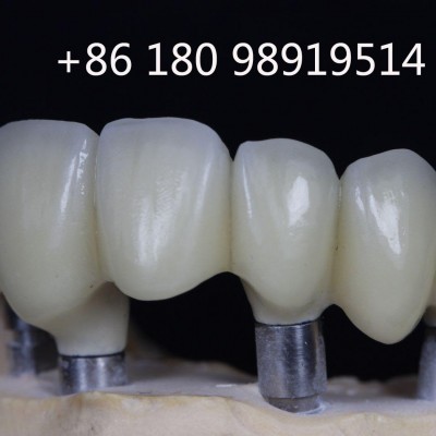 中国义齿加工厂寻求合作 口腔医院/牙科诊所代理销售