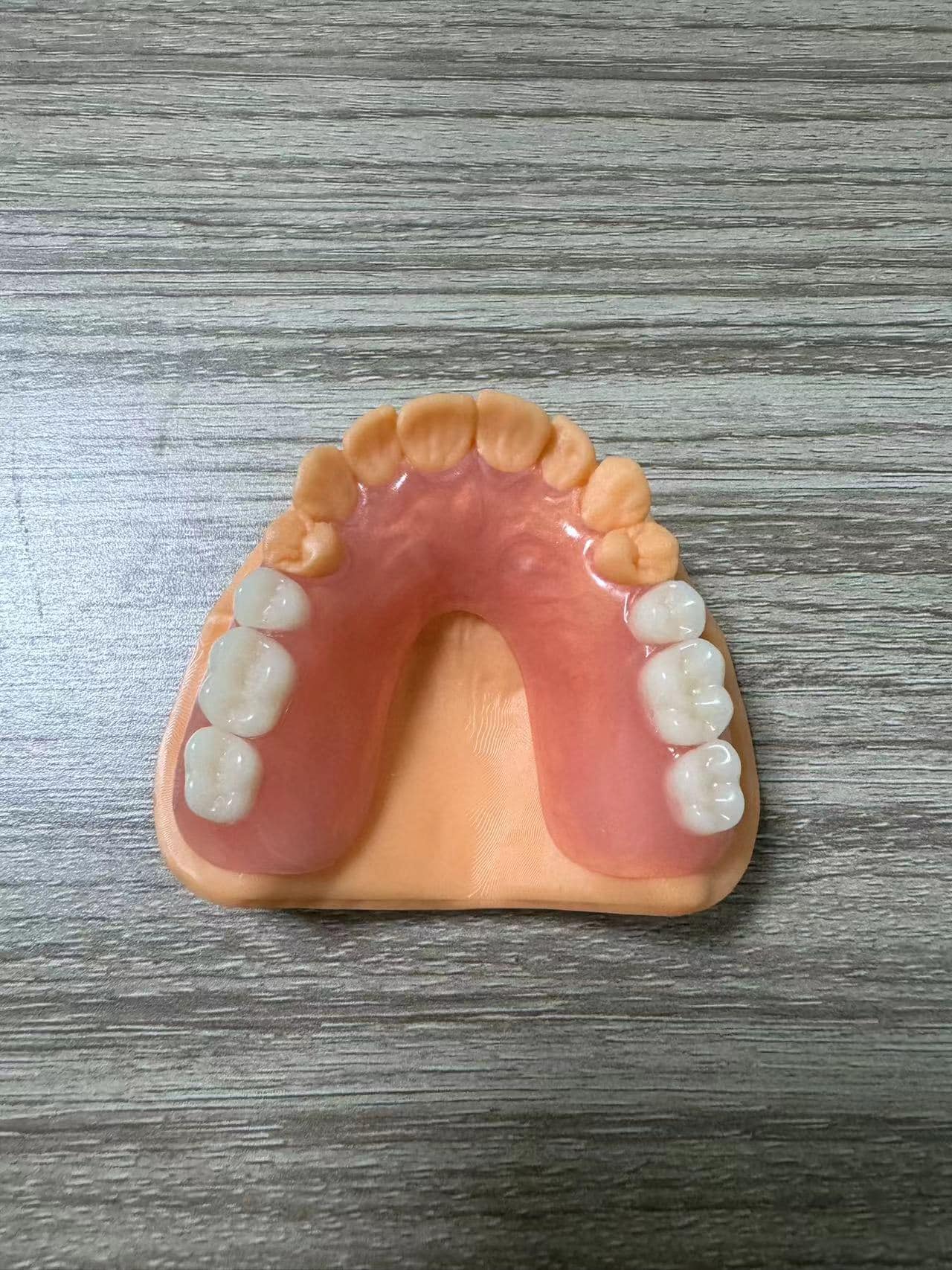 牙齿保持器厂家-隐形矫正品牌
