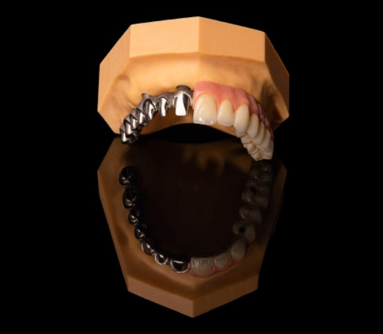 深圳定制义齿加工厂提供活动义齿、种植义齿和正畸义齿制作