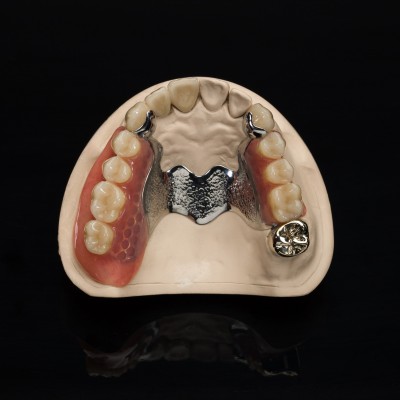 深圳义齿加工厂为你提供制作活动义齿 3D打印钢托 出口